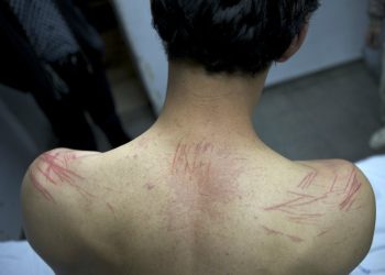 ¡IMPACTANTE! Conoce los métodos de tortura israelí contra niños y niñas palestinos