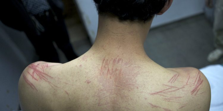 ¡IMPACTANTE! Conoce los métodos de tortura israelí contra niños y niñas palestinos