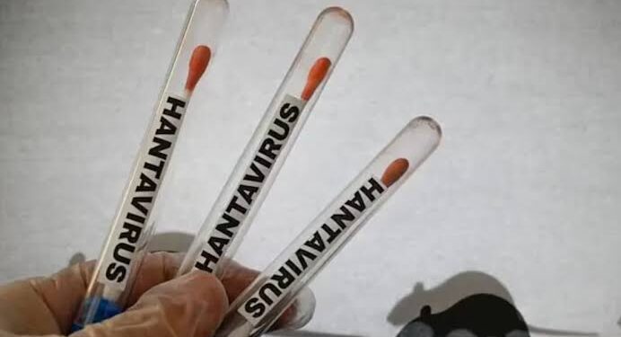 Salud pública activa protocolos tras confirmación de Hantavirus en Anzoátegui y muertes en investigación en Barinas